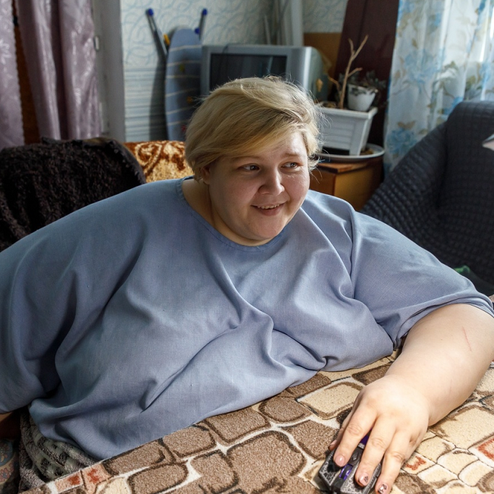 Самая большая женщина в стране, Наталья Руденко, похудела и стала красоткой.