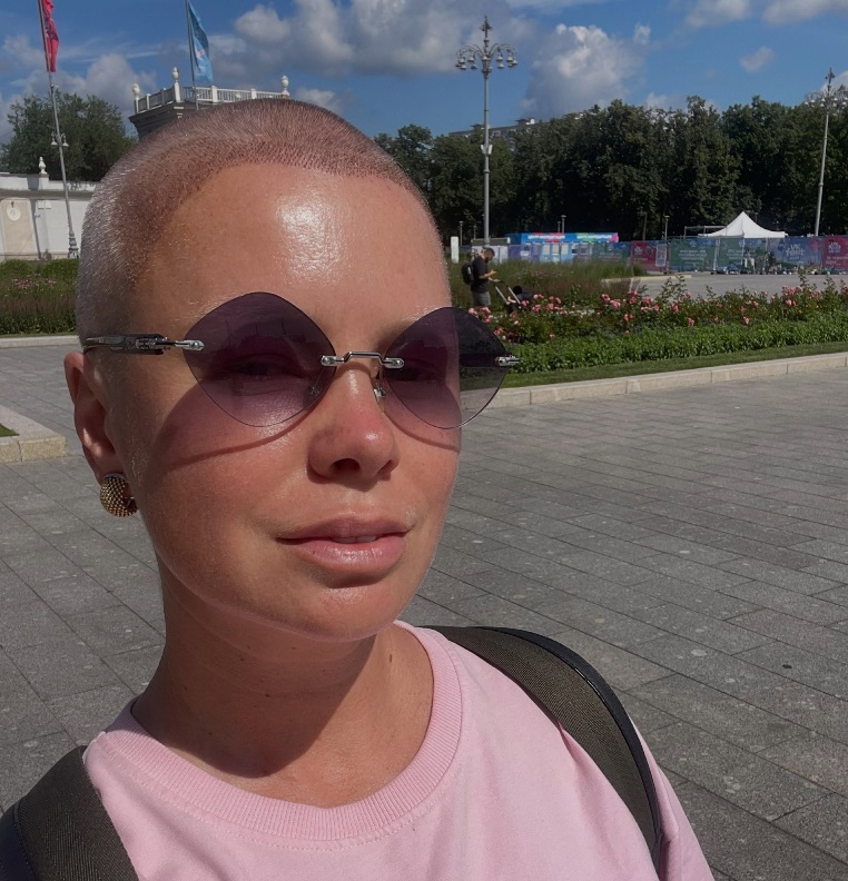В 40 лет начала жизнь заново: бросила пить, похудела на 17 кг и пересадила волосы. Как живет Евгения Осипова